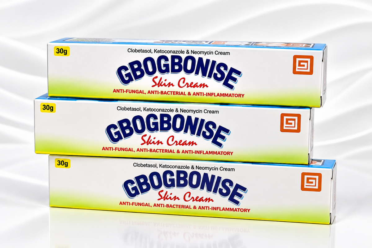 Three stacked boxes of Gbogbonise Skin Cream, 30g each, displayed on a clean white background with a subtle reflection.