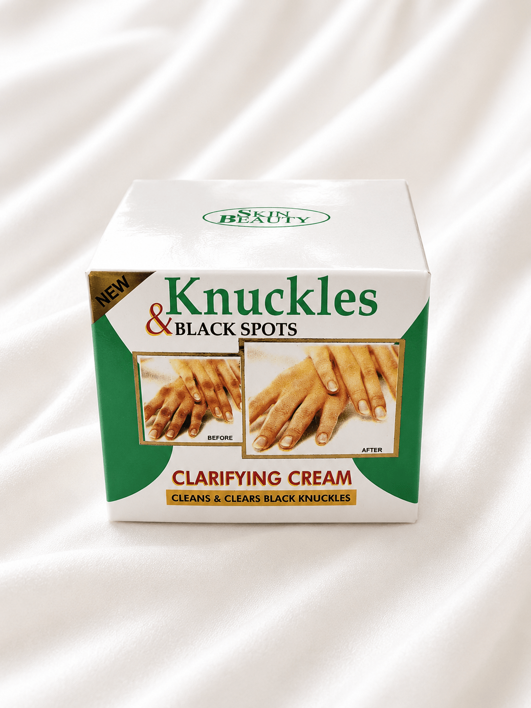 Skin Beauty Knuckles & Black Spots Clarifying Cream - Skincare - Cherubim Aura